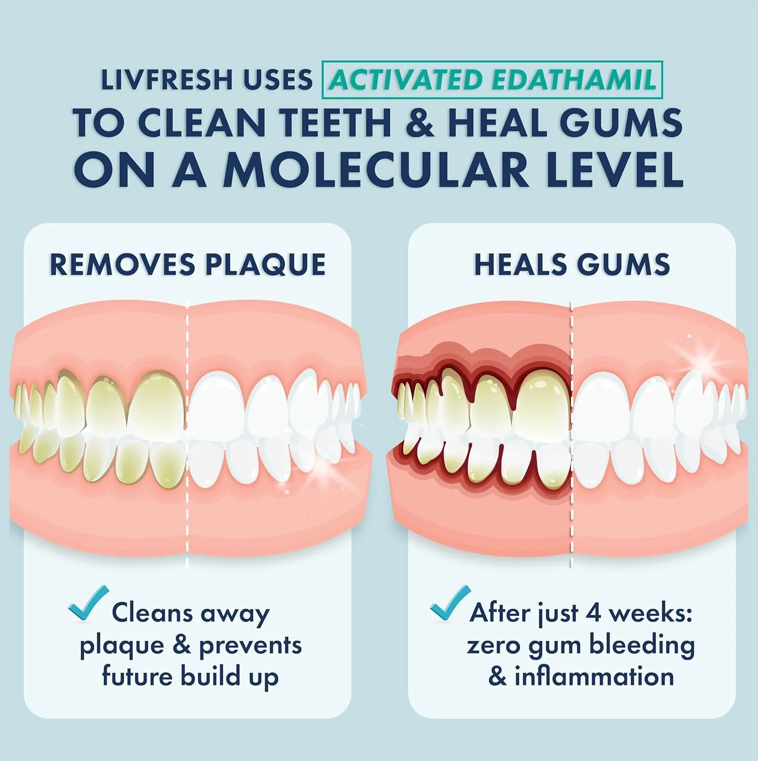 Toothpaste Gel, Clinically Proven to Remove Plaque 250% Better, Improves Gum Health 190% Better, Prevents & Reduces Tartar, Peppermint